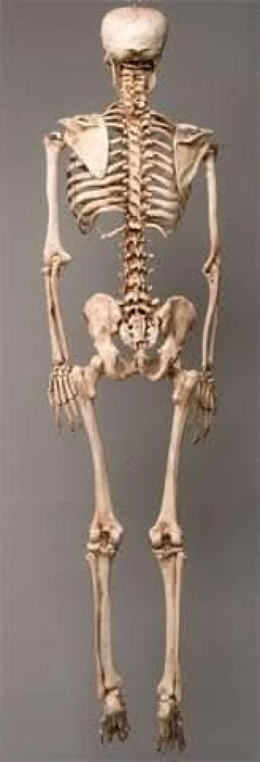 Life-Size Aged Skeleton