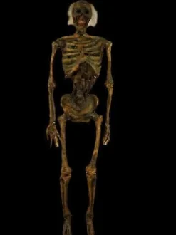 Life- Size Rotted Skeleton