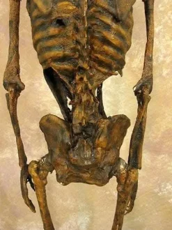 Life- Size Rotted Skeleton