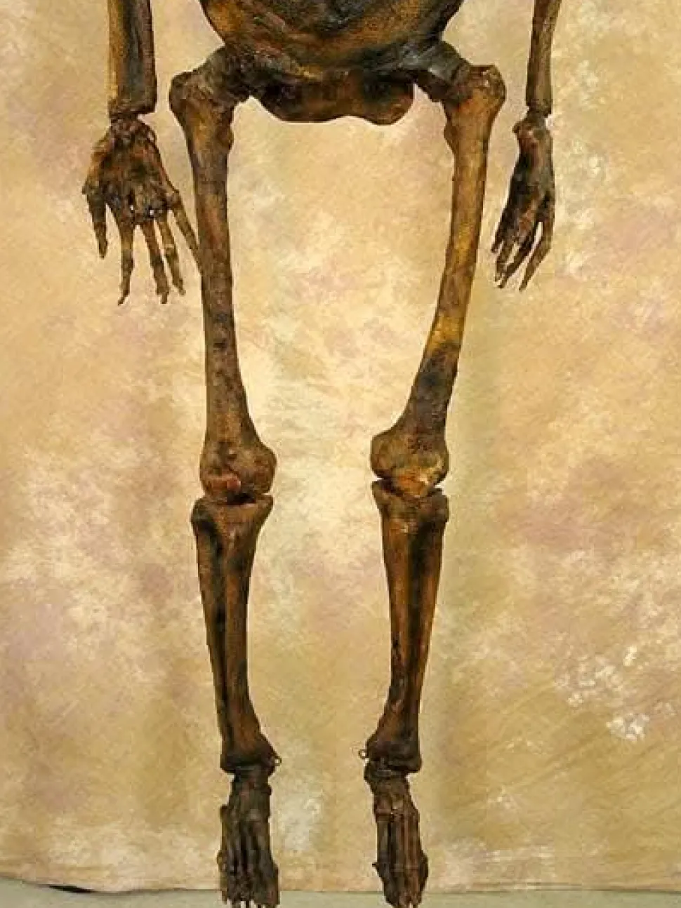 Life- Size Rotted Skeleton