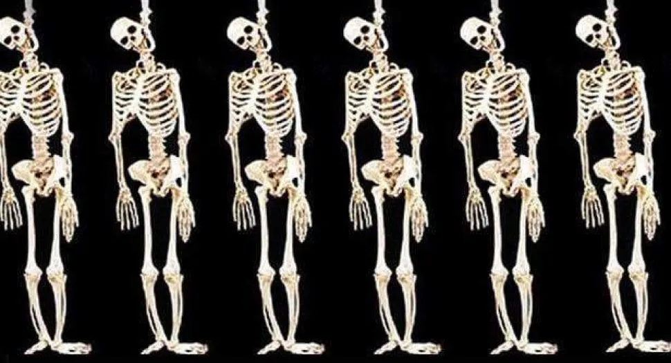 Skeleton Halloween Props - 6x Package Deal